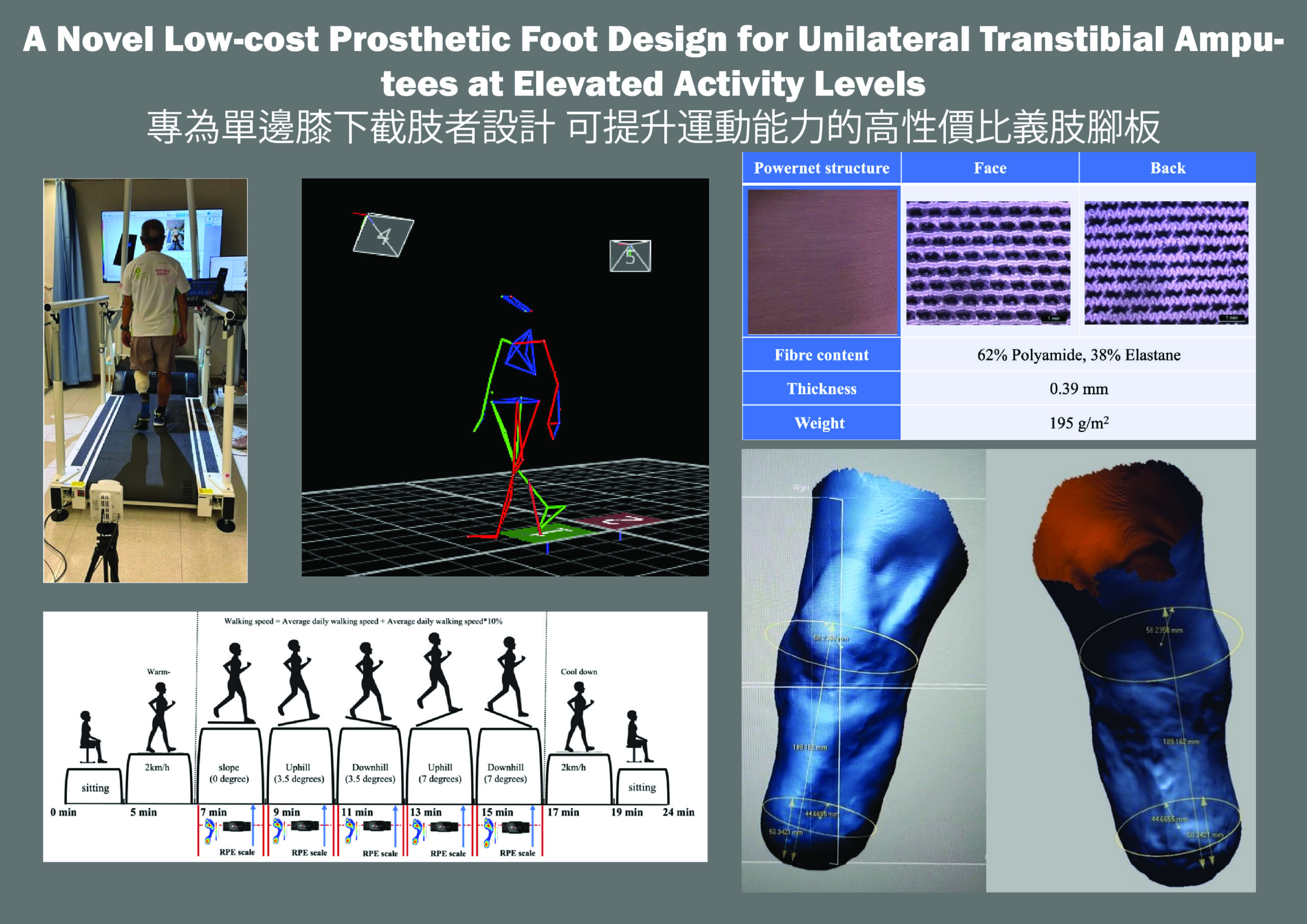 A Novel Low-cost Prosthetic Foot Design for Unilateral Transtibial Amputees at Elevated Activity Levels